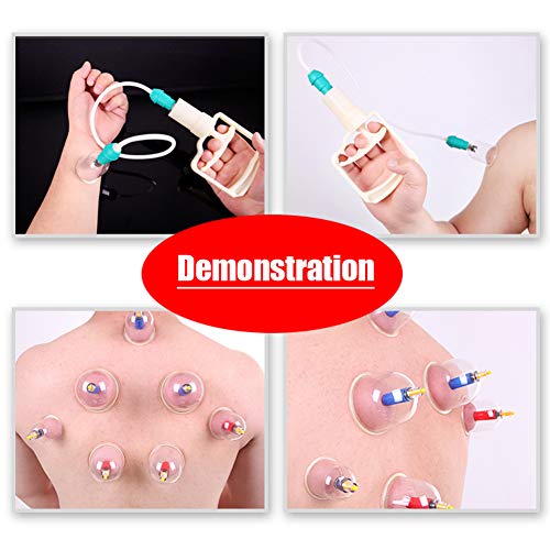 24 x ventosas, Ahuecamiento, Tratamiento Ventosas Masaje, Terapia biomagnética Tradicional China Cupping Set Hogar Sacar Vacío Cupping Kit/Chino Masaje Medical Hijama Set Succión Acupuntura