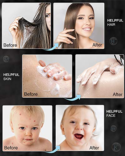 ADOVEL 2019 Filtro para Ducha Universal de alta Salida, con nueva Columna de Calcio de alta Eficiencia de Sulfito de Calcio, Purificador de múltiples Etapas, Elimina Cloro Flúor Metales Pesados ADOVEL 2019 Filtro para Ducha Universal de alta Salida, con nueva Columna de Calcio de alta Eficiencia de Sulfito de Calcio, Purificador de múltiples Etapas, Elimina Cloro Flúor Metales Pesados