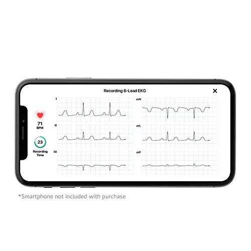AliveCor KardiaMobile 6L| El monitor de ECG personal de 6 pistas que funciona con tu teléfono inteligente. Detecta fibrilación atrial en solo 30 segundos - en cualquier momento, en cualquier lugar.
