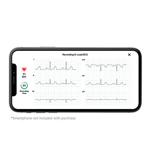 AliveCor KardiaMobile 6L| El monitor de ECG personal de 6 pistas que funciona con tu teléfono inteligente. Detecta fibrilación atrial en solo 30 segundos - en cualquier momento, en cualquier lugar. AliveCor KardiaMobile 6L| El monitor de ECG personal de 6 pistas que funciona con tu teléfono inteligente. Detecta fibrilación atrial en solo 30 segundos - en cualquier momento, en cualquier lugar.