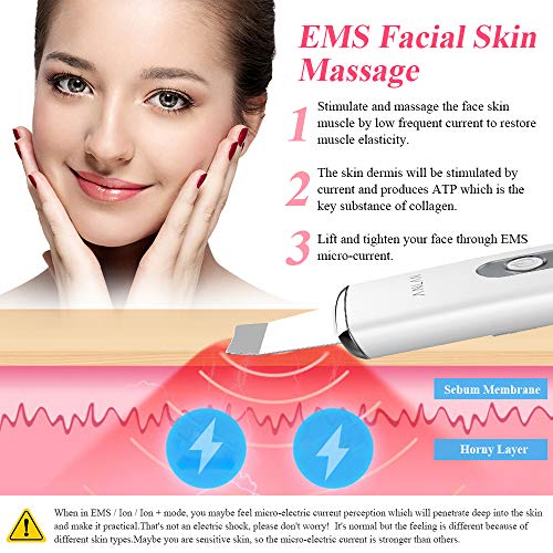 ANLAN Peeling Ultrasónico Facial Skin Scrubber con USB Recargable para Limpieza Facial, Cuidado Facial y Exfoliación Facial