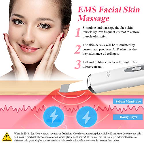 ANLAN Peeling Ultrasónico Facial Skin Scrubber con USB Recargable para Limpieza Facial, Cuidado Facial y Exfoliación Facial ANLAN Peeling Ultrasónico Facial Skin Scrubber con USB Recargable para Limpieza Facial, Cuidado Facial y Exfoliación Facial