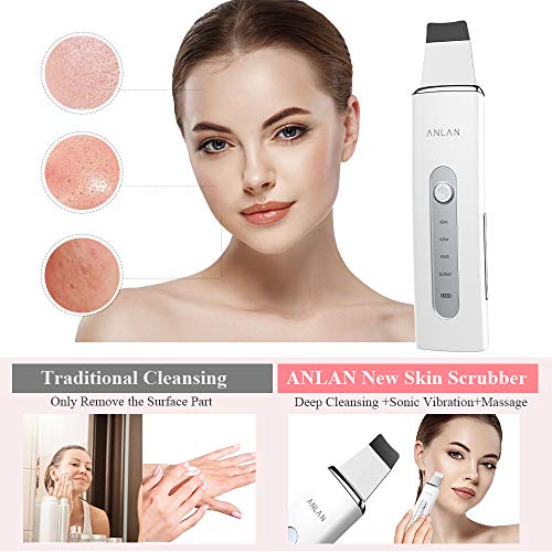 ANLAN Peeling Ultrasónico Facial Skin Scrubber con USB Recargable para Limpieza Facial, Cuidado Facial y Exfoliación Facial