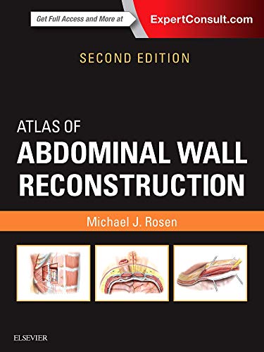 Atlas of Abdominal Wall Reconstruction, 2e: Expert Consult - Online and Print