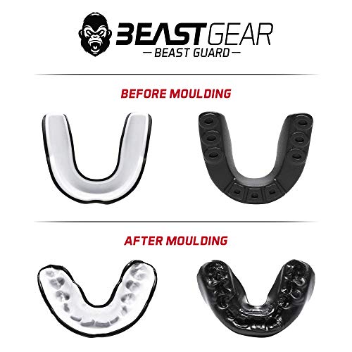 Beast Gear - Protector Bucal Boxeo/Protector de Encía 'Beast Guard' - para Boxeo, MMA, Rugby, Muay Thai, Hockey, Judo, Karate, Artes Marciales y Todos los Deportes de Contacto Beast Gear - Protector Bucal Boxeo/Protector de Encía 'Beast Guard' - para Boxeo, MMA, Rugby, Muay Thai, Hockey, Judo, Karate, Artes Marciales y Todos los Deportes de Contacto