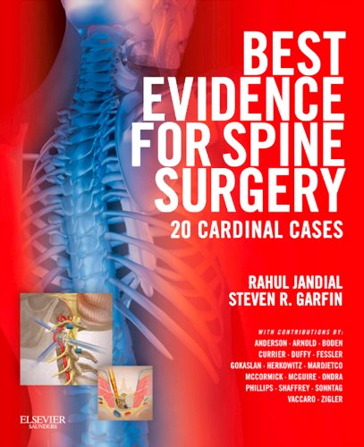 Best Evidence for Spine Surgery E-Book: 20 Cardinal Cases (English Edition)