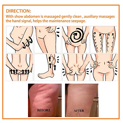 Crema adelgazante Gel 250g celulitis profesional y crema reafirmante para el cuidado de la piel, para el cuerpo que forma Quema de grasa Pierde Crema adelgazante Gel 250g celulitis profesional y crema reafirmante para el cuidado de la piel, para el cuerpo que forma Quema de grasa Pierde