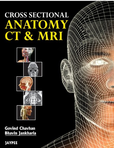 Cross Sectional Anatomy CT and MRI (English Edition)