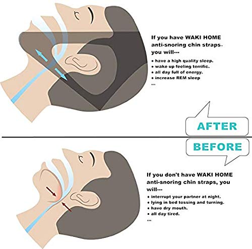 Deje de jugar o duerma apnea cinturón soporte de mentón cinturón de estiramiento facial cinturón de estiramiento facial Deje de jugar o duerma apnea cinturón soporte de mentón cinturón de estiramiento facial cinturón de estiramiento facial