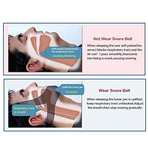 Duevin deja de roncar Correa para la barbilla, vendaje de estiramiento facial sin dolor Cinturón antirronquidos Apnea Solución de soporte para la mandíbula Sueño
