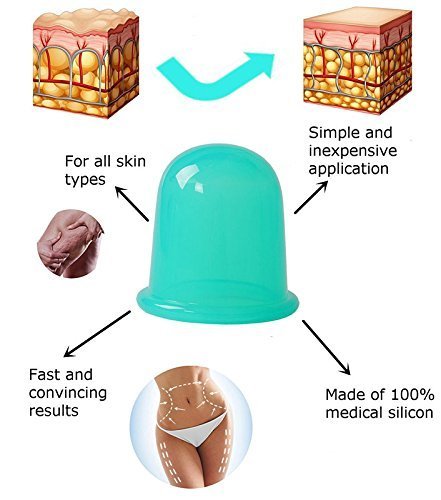 El tratamiento anti celulitis, Copas Masaje Celulitis El tratamiento anti celulitis, Copas Masaje Celulitis