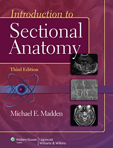 Introduction to Sectional Anatomy (Point (Lippincott Williams & Wilkins)) (English Edition) Introduction to Sectional Anatomy (Point (Lippincott Williams & Wilkins)) (English Edition)