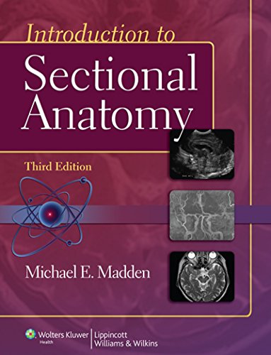 Introduction to Sectional Anatomy (Point (Lippincott Williams & Wilkins)) (English Edition)