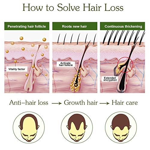 Sérum de crecimiento del cabello, antipérdida de cabello, para acelerar el crecimiento del cabello, promueve más cabello ticker, más completo y más rápido crecimiento Sérum de crecimiento del cabello, antipérdida de cabello, para acelerar el crecimiento del cabello, promueve más cabello ticker, más completo y más rápido crecimiento