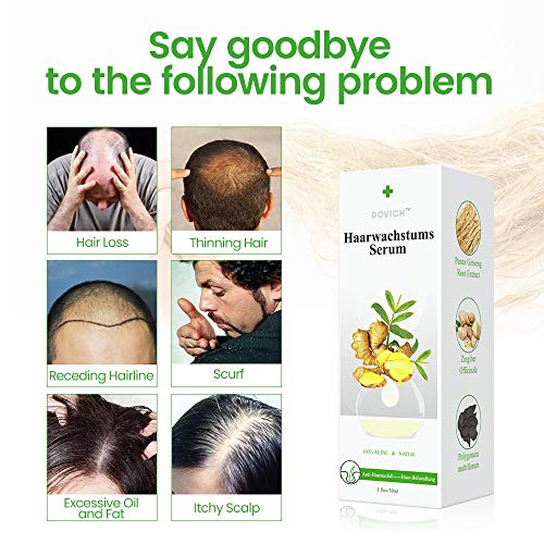 Serum de Crecimiento del Cabello con Esencia de Jengibre para Anticaida de Cabello y Crece Pelo, Nutrir los Folículo Piloso de hombres y mujeres para el Crece Rápido y Completo del Cabello Serum de Crecimiento del Cabello con Esencia de Jengibre para Anticaida de Cabello y Crece Pelo, Nutrir los Folículo Piloso de hombres y mujeres para el Crece Rápido y Completo del Cabello