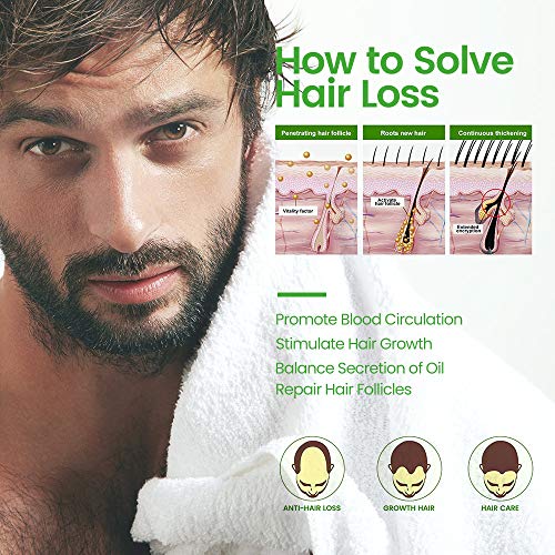 Serum de Crecimiento del Cabello con Esencia de Jengibre para Anticaida de Cabello y Crece Pelo, Nutrir los Folículo Piloso de hombres y mujeres para el Crece Rápido y Completo del Cabello Serum de Crecimiento del Cabello con Esencia de Jengibre para Anticaida de Cabello y Crece Pelo, Nutrir los Folículo Piloso de hombres y mujeres para el Crece Rápido y Completo del Cabello