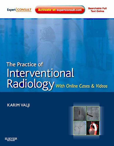 The Practice of Interventional Radiology, with Online Cases and Video E-Book: Expert Consult Premium Edition - Enhanced Online Features (Expert Consult Title: Online + Print) (English Edition)