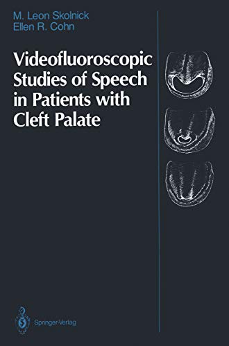 Videofluoroscopic Studies of Speech in Patients with Cleft Palate (English Edition)