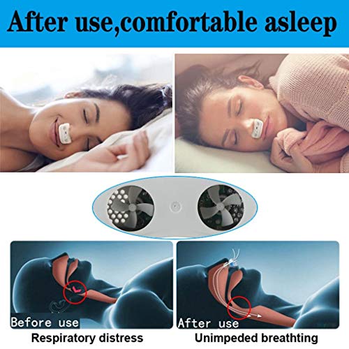 Yowerf Aparato electrónico de respiración Nasal antirronquidos Los dilatadores apnea del sueño ayudan al Equipo a Detener el Equipo de ronquido (Color : Blanco)