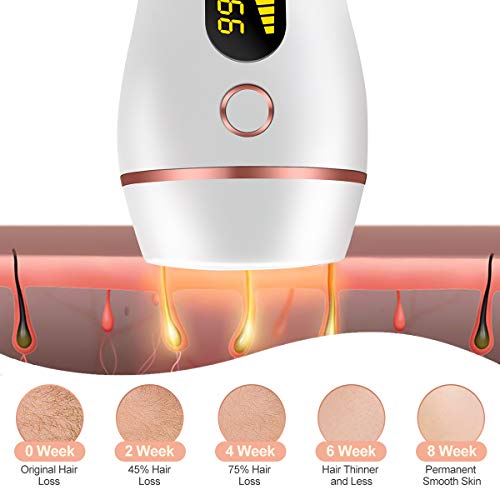 ZumYu IPL Depiladora de Luz Pulsada, 999,999 Flashes Disparos de Depilación Permanente para Cuerpo y Cara Dispositivo Láser Profesional sin Dolor para el Hogar para Cuerpo y Cara, para Mujer y Hombre