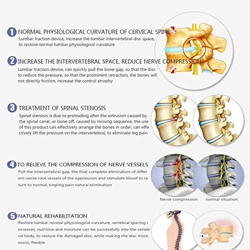 ZYQDRZ Dispositivo De Tracción De La Columna Vertebral, Cama De Tracción Lumbar, Camilla De Cuerpo Completo para El Hogar, Alivia El Dolor De Columna En El Cuello Y La Columna Lumbar