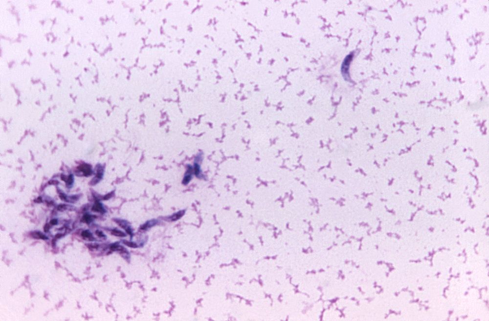 El parásito encontrado en la caca de gato está relacionado con un mayor riesgo de cáncer cerebral en los humanos