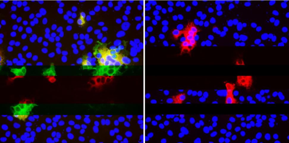 La forma sigilosa en que el coronavirus muta para escapar del sistema inmunitario