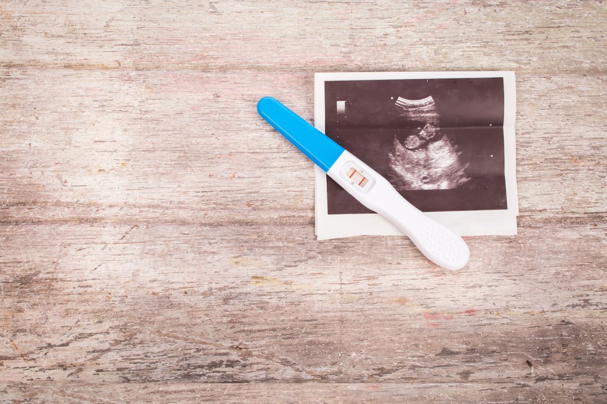 Una mujer da a luz a gemelos concebidos con tres semanas de diferencia