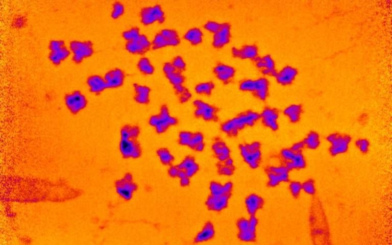 Los científicos están desconcertados por el "inexplicable exceso de masa" que acecha a los cromosomas humanos