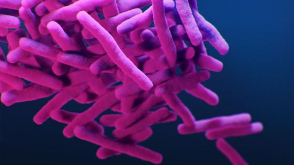 Un gran brote de tuberculosis podría estar causado por un 