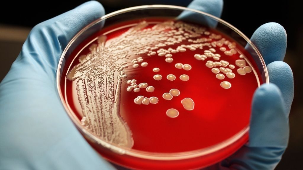 Un nuevo descubrimiento podría ayudar a acabar con las bacterias resistentes a los medicamentos
