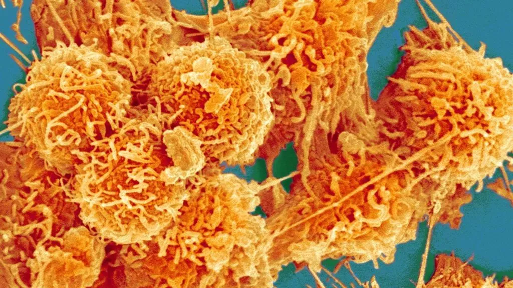 Los antibióticos pueden aumentar el riesgo de cáncer de colon, según un estudio masivo