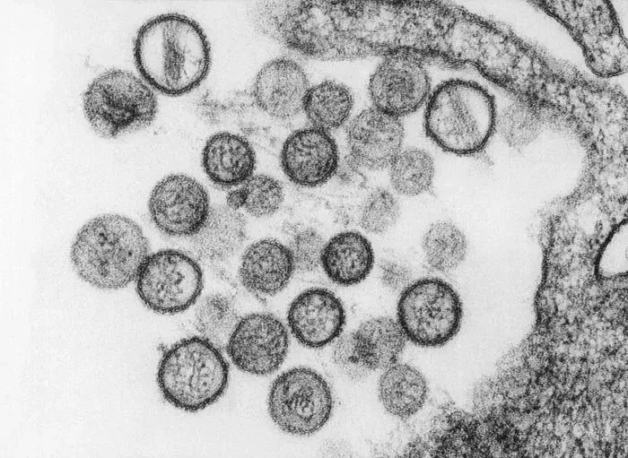 Los virus más mortíferos de la historia