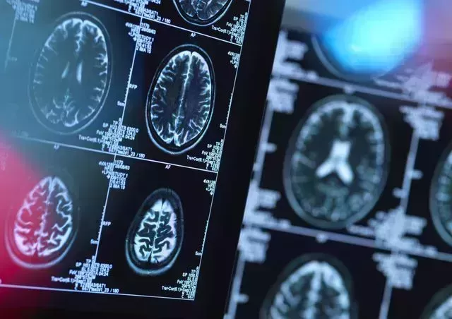 brain scans of possible disease or damage in clinic