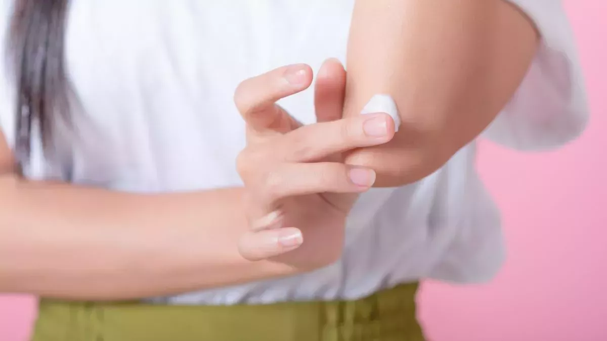 Cómo aliviar los síntomas del eczema