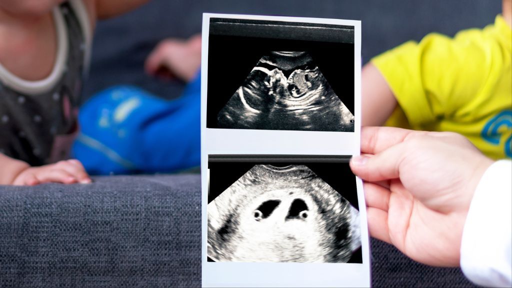 Una mujer de Texas da a luz a un extraño par de gemelos concebidos con una semana de diferencia. ¿Cómo es posible?