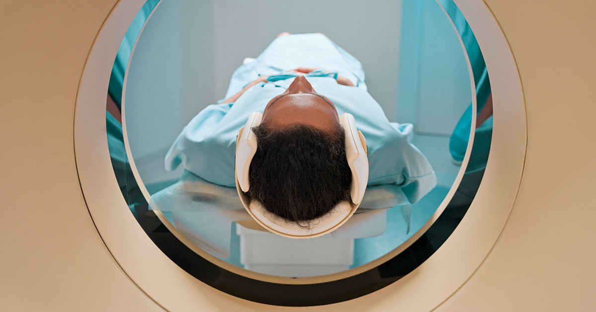 Cómo se utiliza el TAC para diagnosticar el cáncer de páncreas 