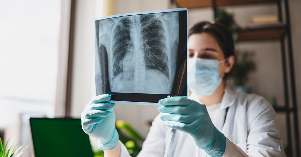 Opacidad pulmonar: Lo que debe saber