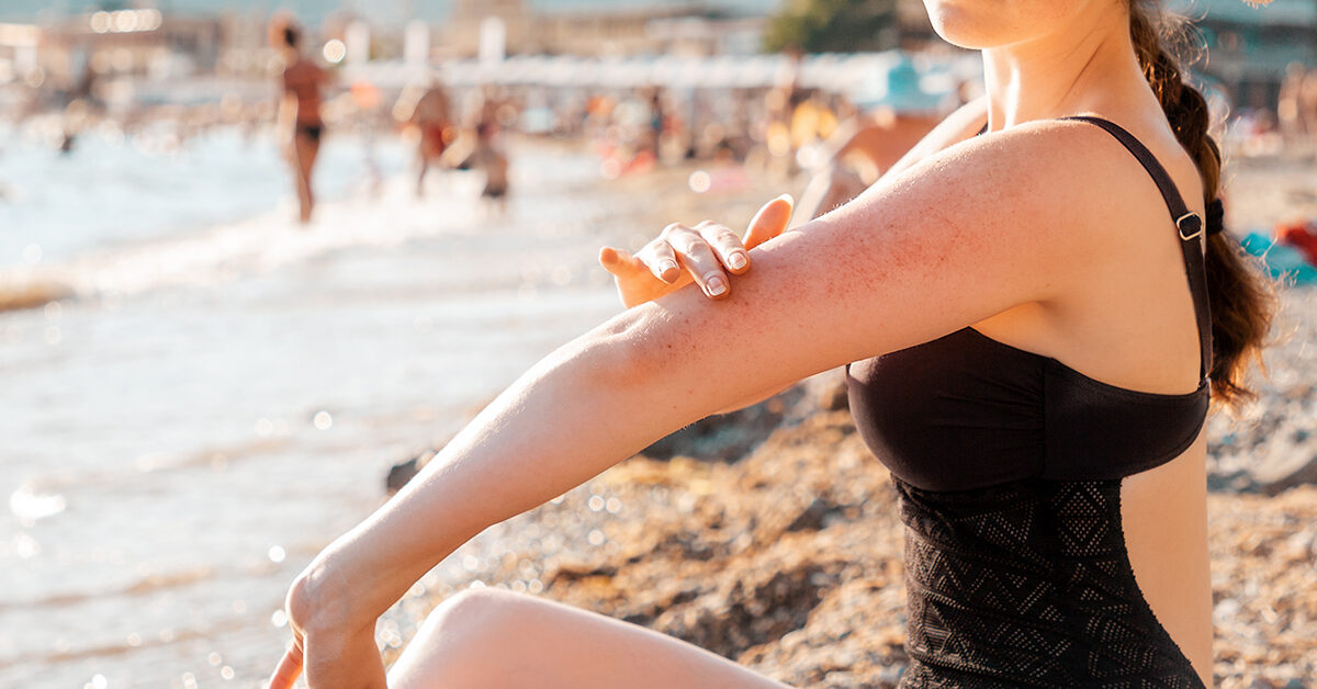 Las alergias más comunes cuando se está en la playa