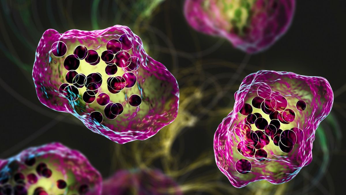 Más de 70 niños enfermos en un brote de sarampión en Ohio