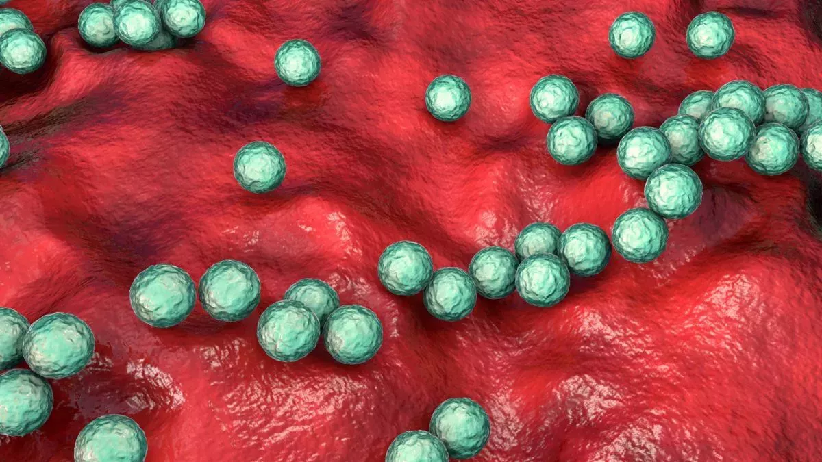 Una peligrosa infección por estreptococos que está aumentando en el Reino Unido podría estar propagándose en EE.UU.