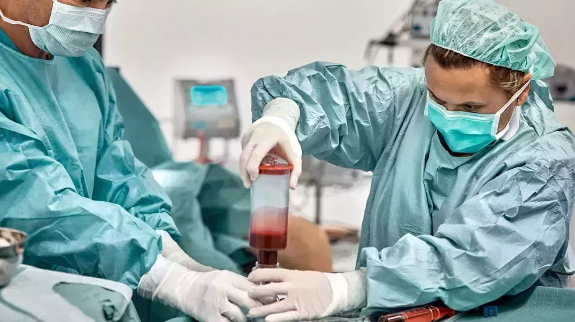Surgeons filtrating bone marrow
