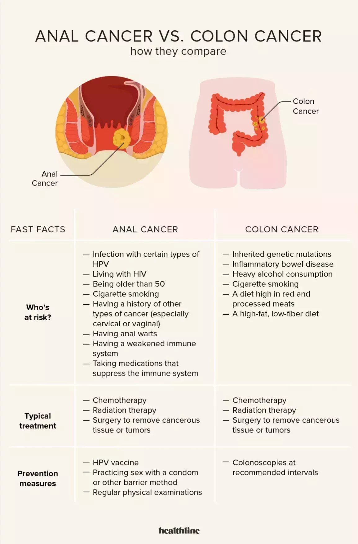 Anal cancer vs colon cancer comparison chart