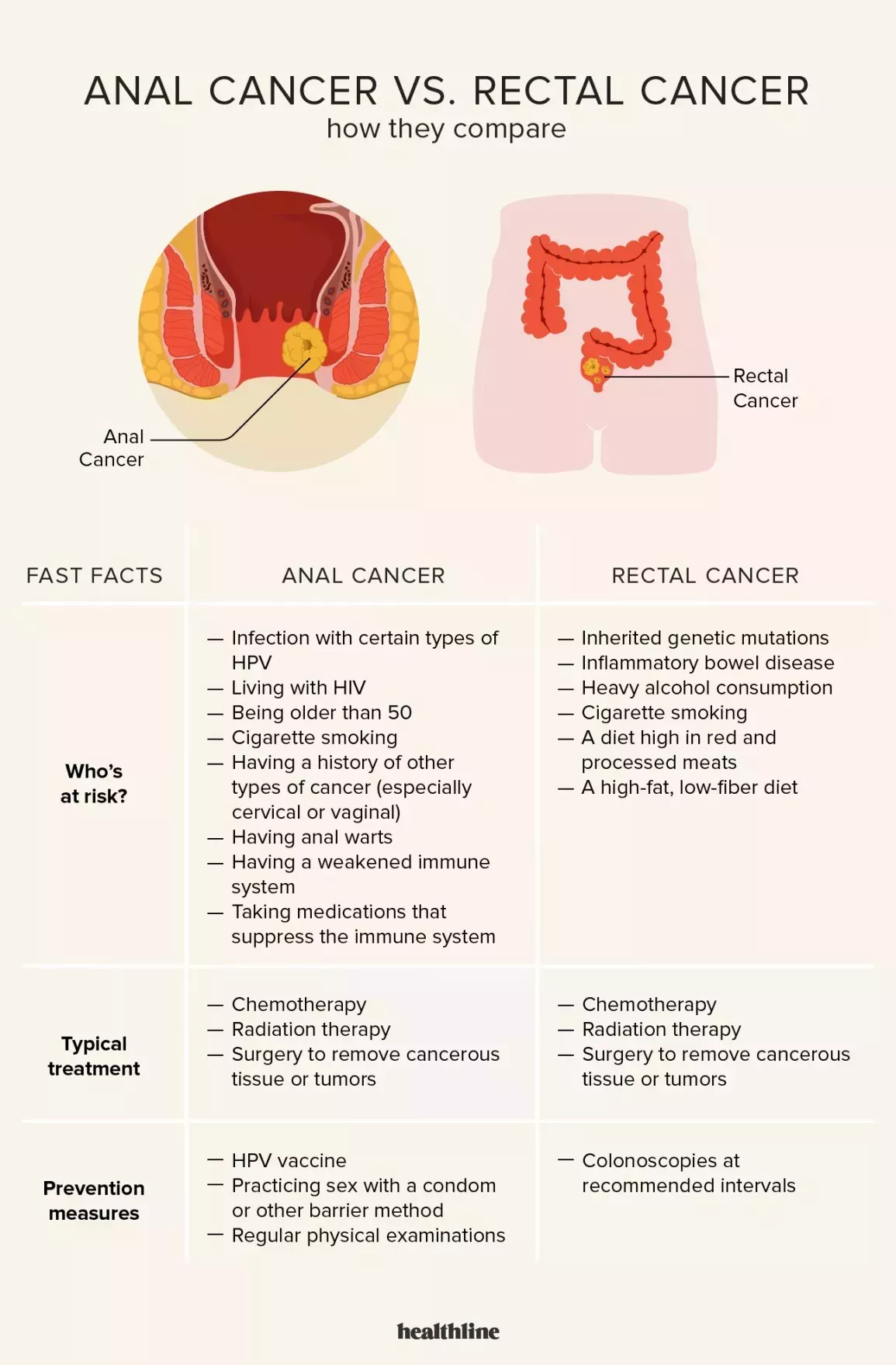 Anal cancer vs. rectal cancer comparison chart