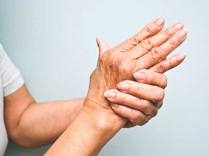 Todo lo que debe saber sobre la artritis psoriásica