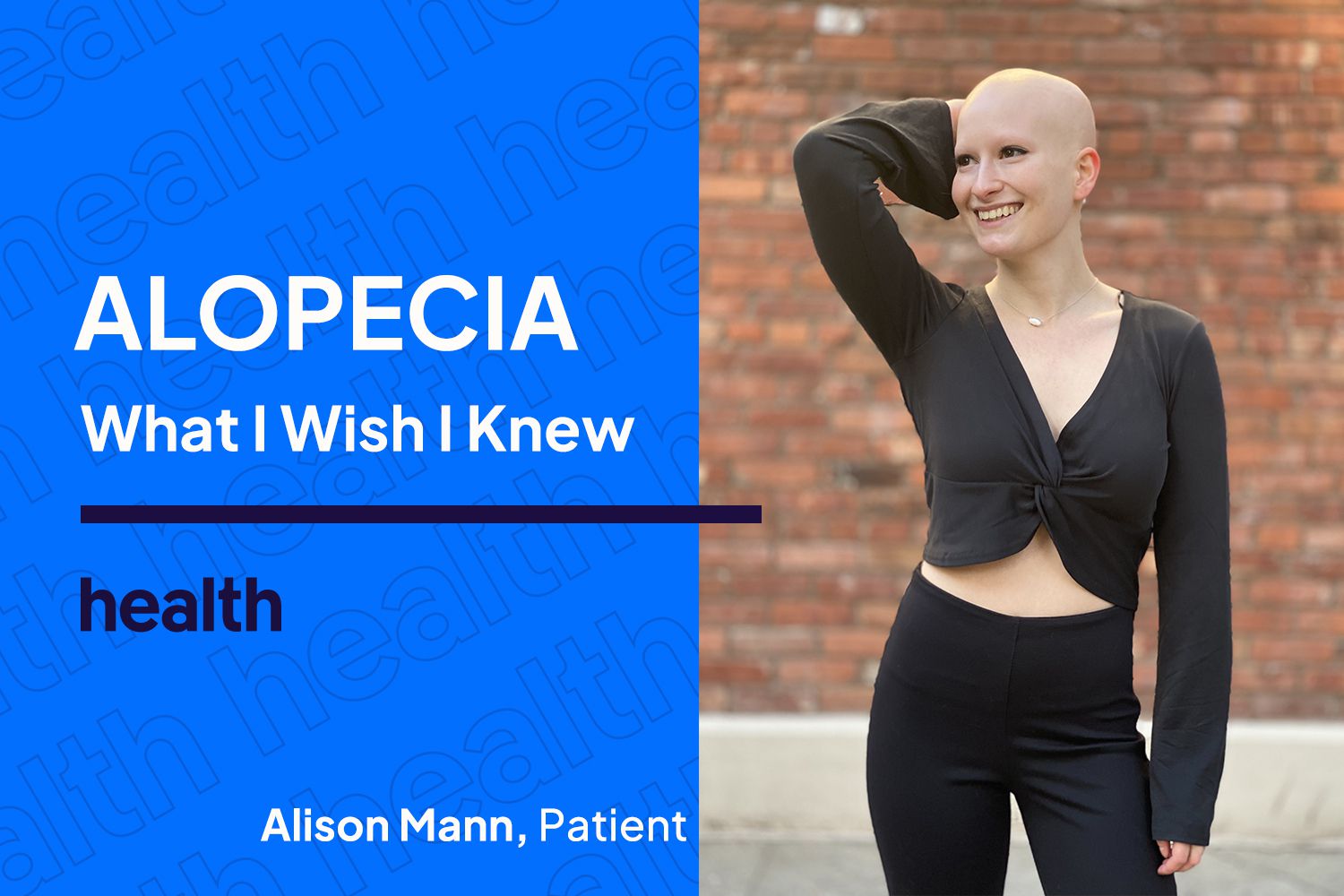 Lo que desearía saber sobre el impacto de la alopecia en la salud mental