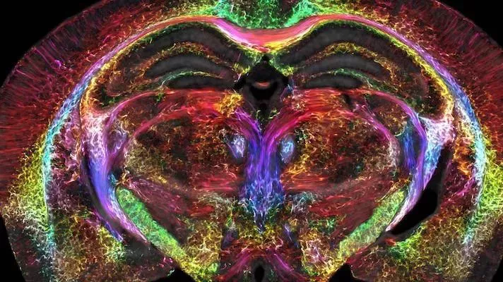 La imagen caleidoscópica del cerebro de un ratón es 64 millones de veces más nítida que una resonancia magnética típica