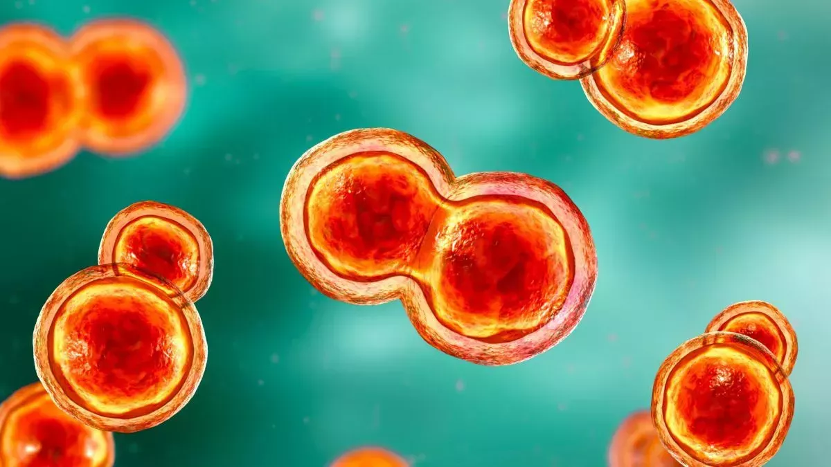 Una infección fúngica