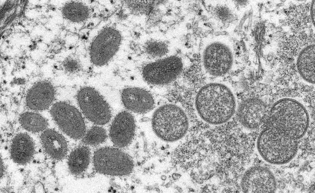 ¿Cómo se propaga la viruela del simio? Expertos en enfermedades infecciosas
