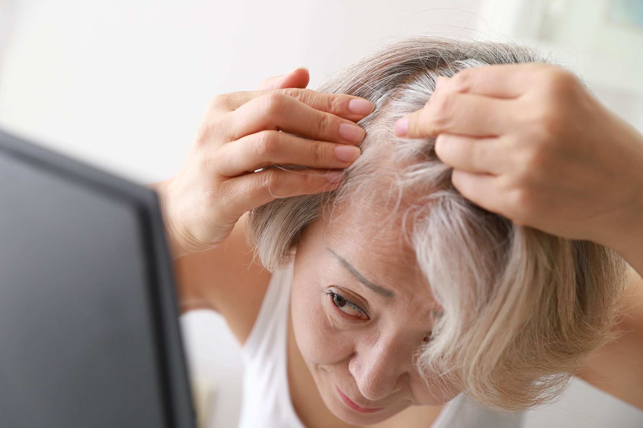 13 causas de las costras en el cuero cabelludo y cómo tratarlas, según los expertos
